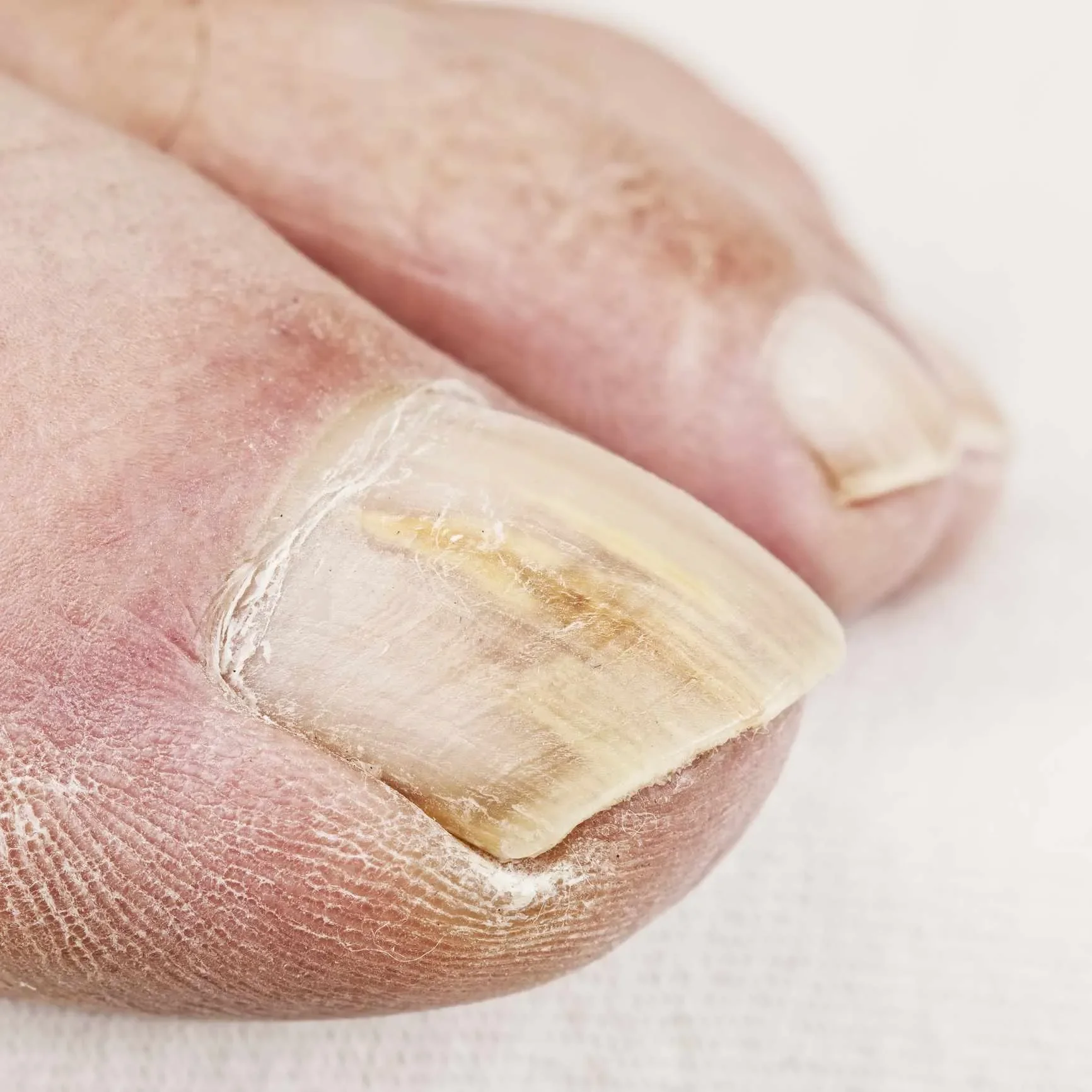 Exofeet oil : σύνθεση μόνο φυσικά συστατικά.